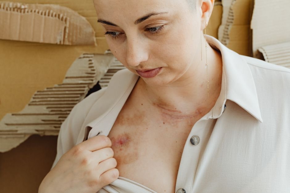 A person photographing a skin concern to send to an online dermatologist